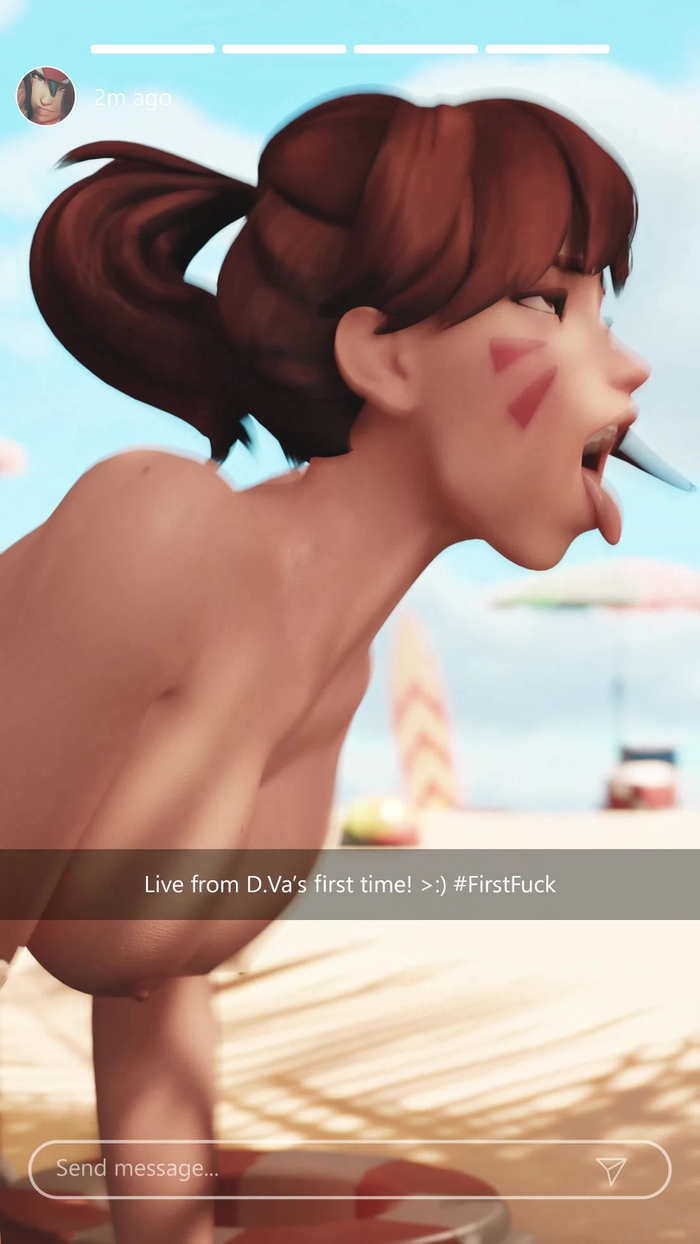 D.Va (Overwatch) 593