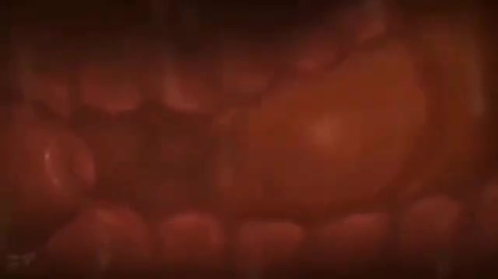 Filled womb